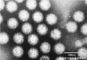 ロタウイルスの電子顕微鏡写真