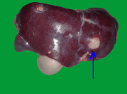 牛の肝膿瘍の写真