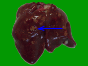 鶏のブドウ球菌症の肝臓写真